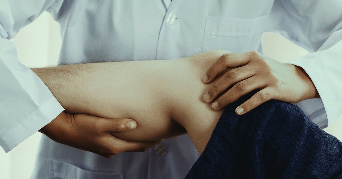 Entorse no joelho: causas, sintomas e opções de tratamento